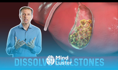 What Causes Gallstones How to Treat Them – Dr Berg