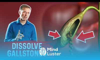 Do This to Help Dissolve Gallstones