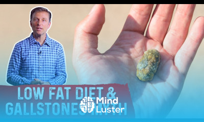 The Low Fat Diet to Prevent Gallstones Myth – Dr Berg