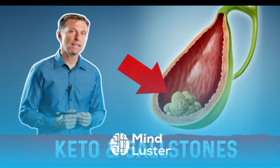Doesn t Keto Cause Gallstones Eating All That Fat