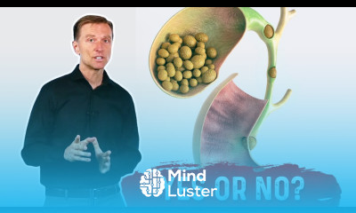 Should I Remove My Gallbladder If I have Stones – Dr Berg