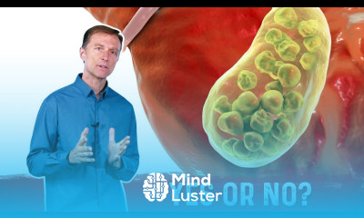 Do Gallstones Come From High Cholesterol – Dr Berg