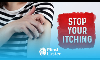 What Causes Hives and Itchiness Urticaria Hives Treatment Dr Berg