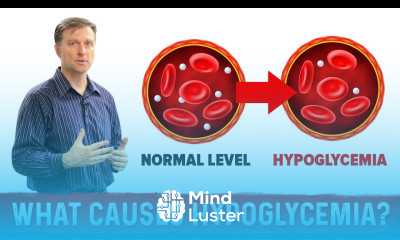 What Causes Hypoglycemia – Dr Berg