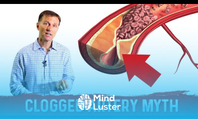 The Clogged Artery Myth – Dr Berg