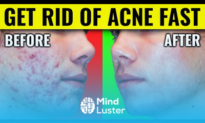 Say Goodbye to Acne Dr Berg s Proven Methods for Clearing Your Skin