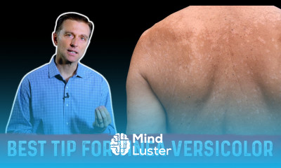 Natural Skin Fungus Tinea Versicolor Home Remedies – Dr Berg