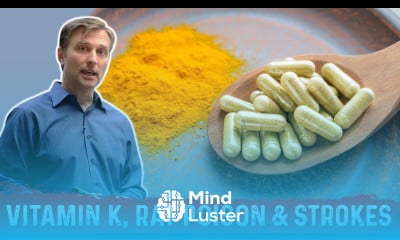 Dr Berg finds What Causes Strokes Vitamin K Warfarin Diet Coumadin
