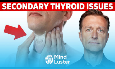 Most Thyroid Issues Are Secondary to Other Problems – Dr Berg