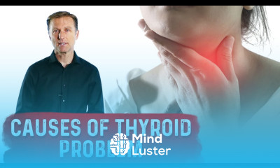 What are the Real Causes of Thyroid Problems – Dr Berg
