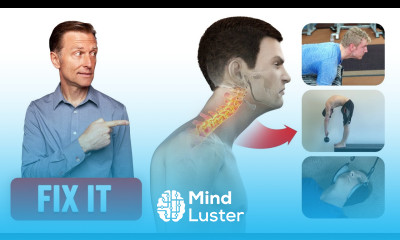 Correct Forward Head Posture with 3 Things Dr Berg