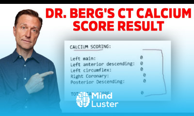 Dr Berg s Reaction on his CT Calcium Scoring Test Result