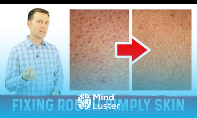 What Does Rough Pimply Skin Chicken Skin or KERATOSIS PILARIS Mean – Dr Berg