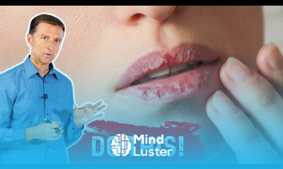 How To Fix Your Chapped Lips – Dr Berg On Remedy For Chapped Lips