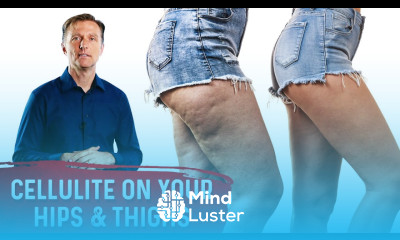 How To Get Rid Of Cellulite On Thighs Buttocks – Dr Berg