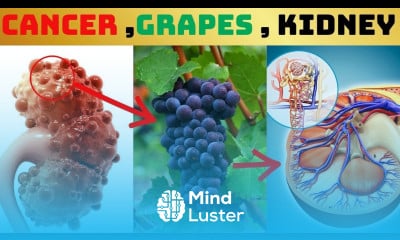 Shocking Foods to Avoid with Grapes for Cancer Dementia Prevention