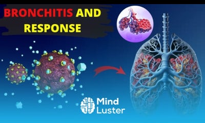 Top Signs of Bronchitis and How to Best Respond