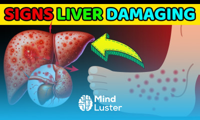 How to Use Your Feet to Diagnose Liver Problems Don t Ignore HealthHarmony Life