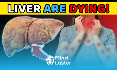 Warning 12 Early Signs of Liver CIRRHOSIS LIVER is DYING