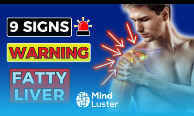9 SIGNS Warning FATTY Liver Issues HealthHarmony Life