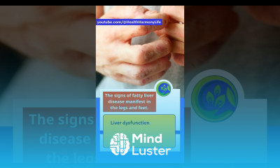 The signs of fatty liver disease manifest in the legs and feet