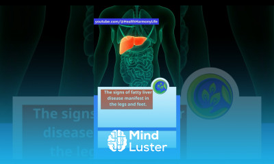 The signs of fatty liver disease manifest in the legs and feet