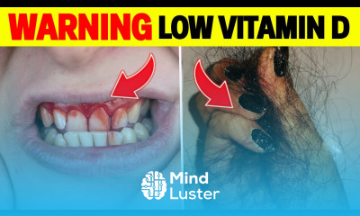 12 WARNING Signs Of Vitamin D DEFICIENCY HealthHarmony Life