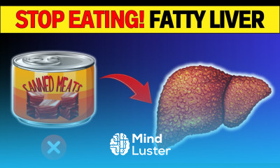 7 Foods That Are Enemies of Fatty Liver and Artery Blockage HealthHarmony Life