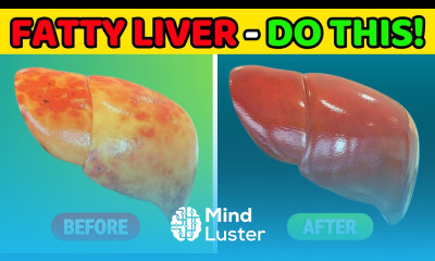 Discover The Shocking Truth About Fatty Liver Signs And Foods That Cleane fatty Liver