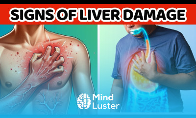 10 Signs Of Liver Damage And Everything You Need To Know bout Fatty Liver