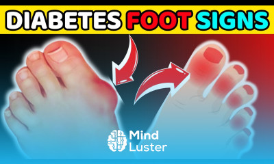 10 Signs Your Feet Tell You About Diabetes HealthHarmony Life