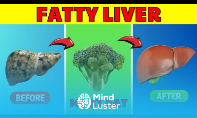 12 BEST FOODS FOR FATTY LIVER DON T IGNORE HealthHarmony Life