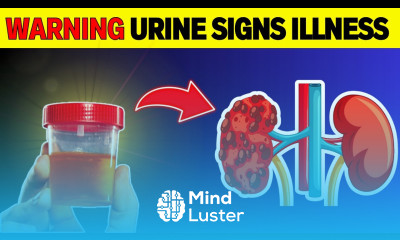 WARNING 5 Unusual URINE Colors Signal A DANGEROUS Health Problem HealthHarmony Life