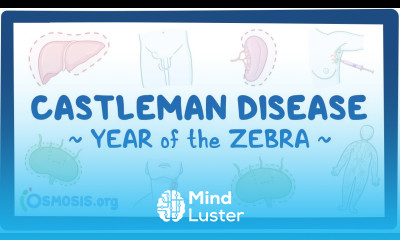 Castleman disease Year of the Zebra
