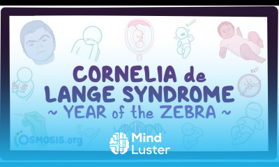Cornelia de Lange syndrome Year of the Zebra