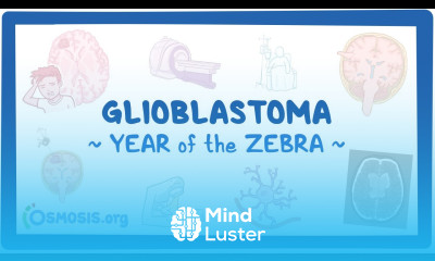 Glioblastoma Year of the Zebra