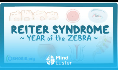 Reiter syndrome Year of the Zebra