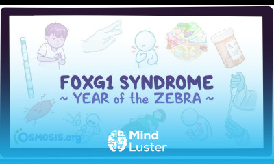 FOXG1 syndrome Year of the Zebra