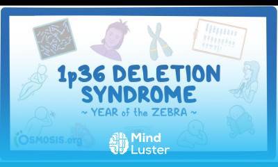 1p36 deletion syndrome Year of the Zebra