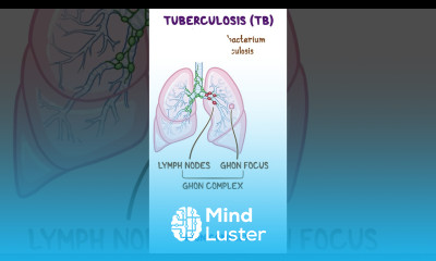 Clinical Cuts Mycobacterium tuberculosis