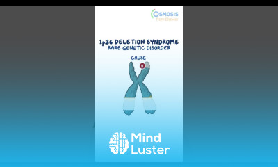 1p36 Deletion Syndrome