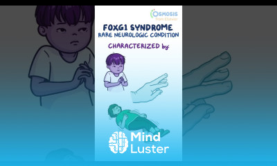 FOXG1 Syndrome