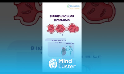 Fibromuscular Dysplasia