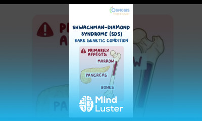 Shwachman Diamond Syndrome