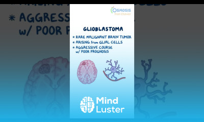 Glioblastoma