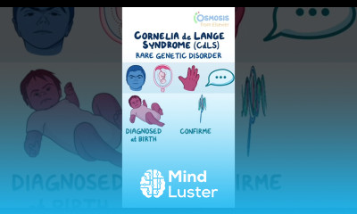 Cornelia de Lange Syndrome