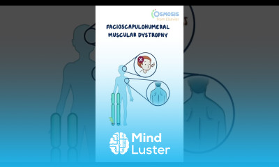 Facioscapulohumeral Muscular Dystrophy