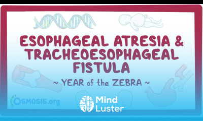 Esophageal atresia tracheoesophageal fistula Year of the Zebra