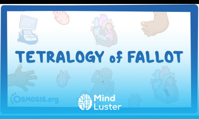 Tetralogy of Fallot Year of the Zebra