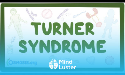 Turner syndrome Year of the Zebra